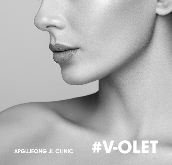 V-OLET